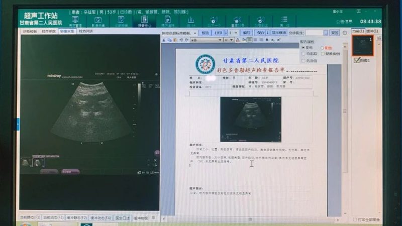 全身扫描与局部扫描：体检中的关键区别